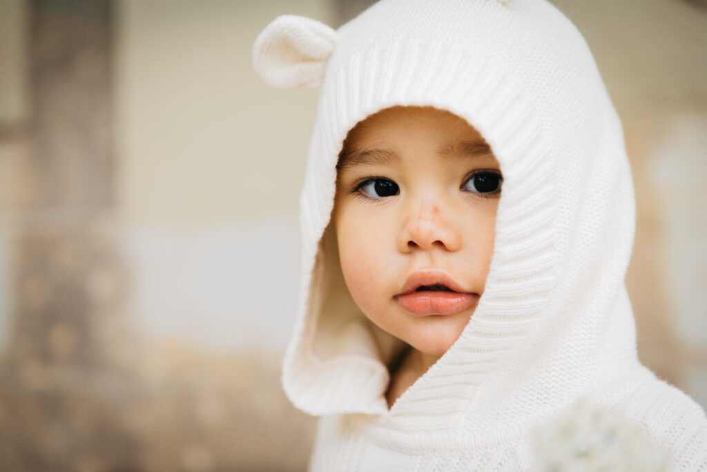 san-francisco-bay-area-family-photographer-carmen-dunham-photography-and-filmsIMG_7059-2 portrait of girl with scratch on her nose